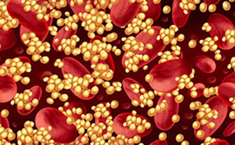  A Quick Guide to Cholesterol and its Types